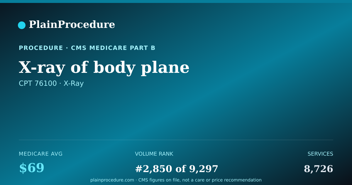 Shareable card for X-Ray Of Body Plane
