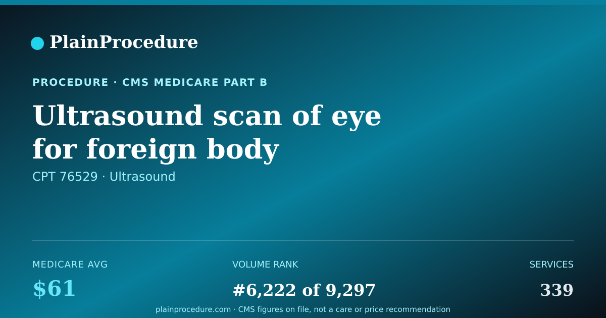 Shareable card for Ultrasound Scan Of Eye For Foreign Body Localization