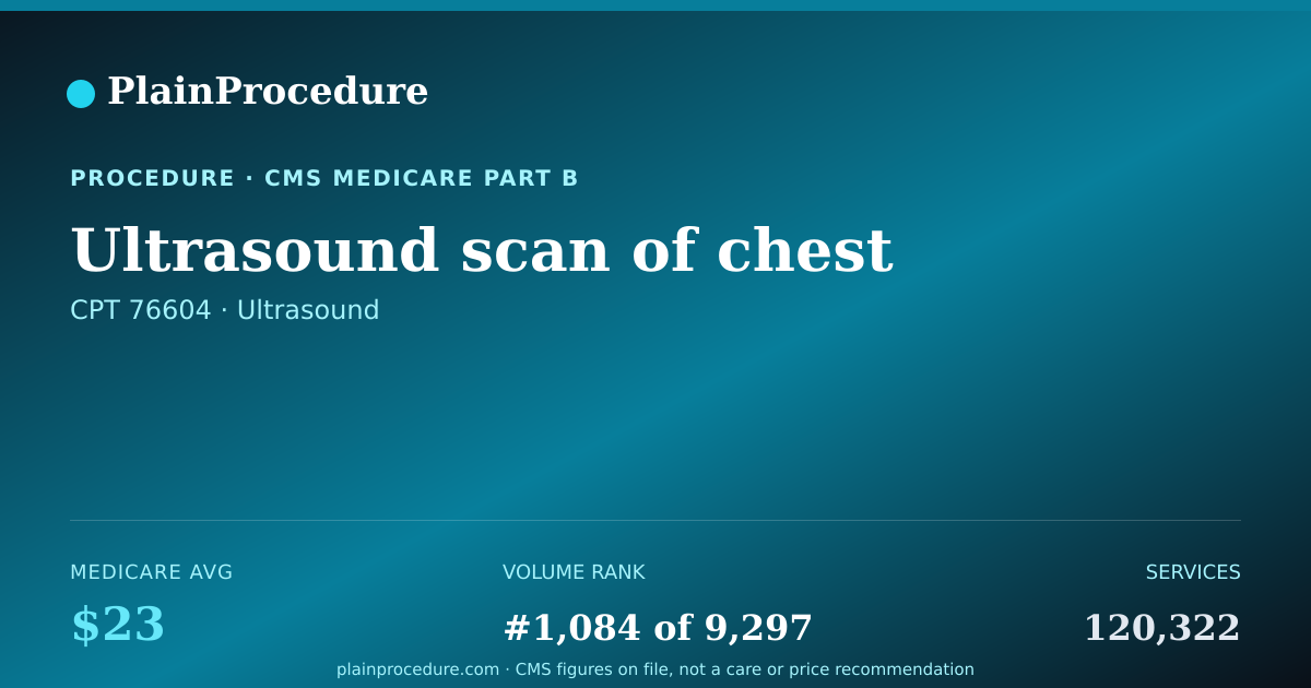 Shareable card for Ultrasound Scan Of Chest