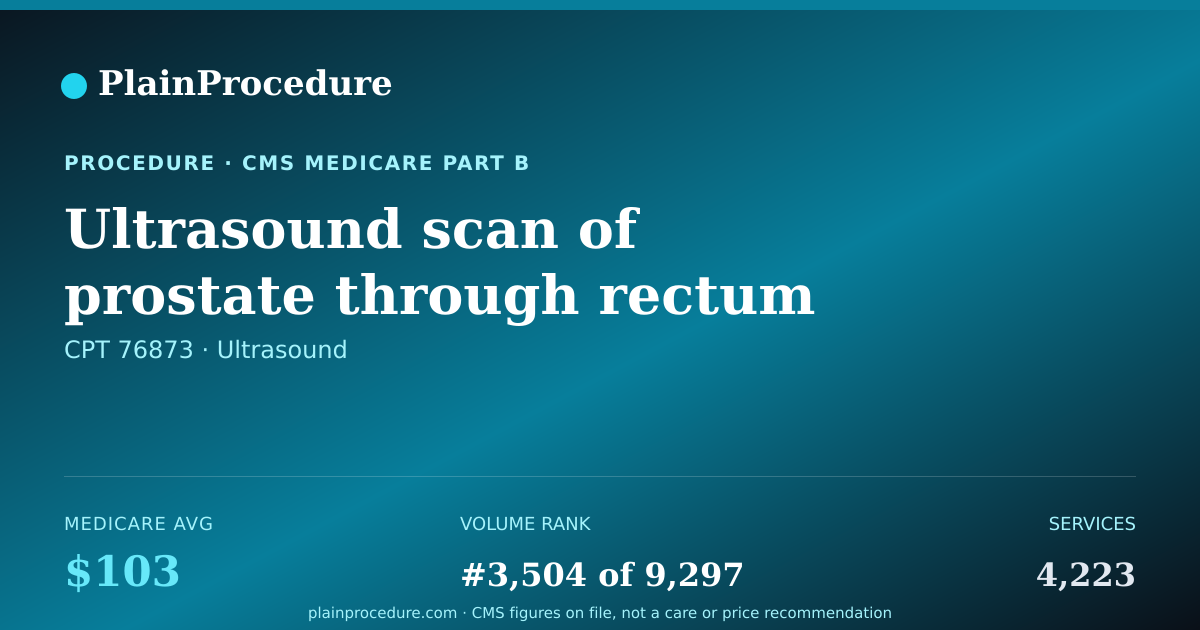 Shareable card for Ultrasound Scan Of Prostate Through Rectum