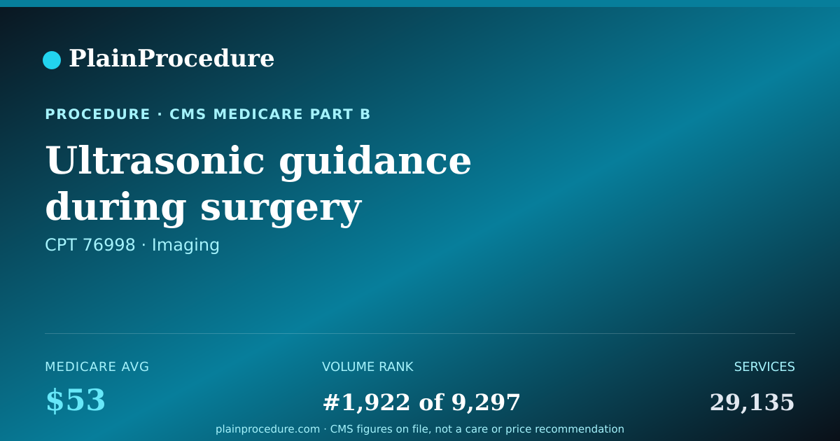 Shareable card for Ultrasonic Guidance During Surgery