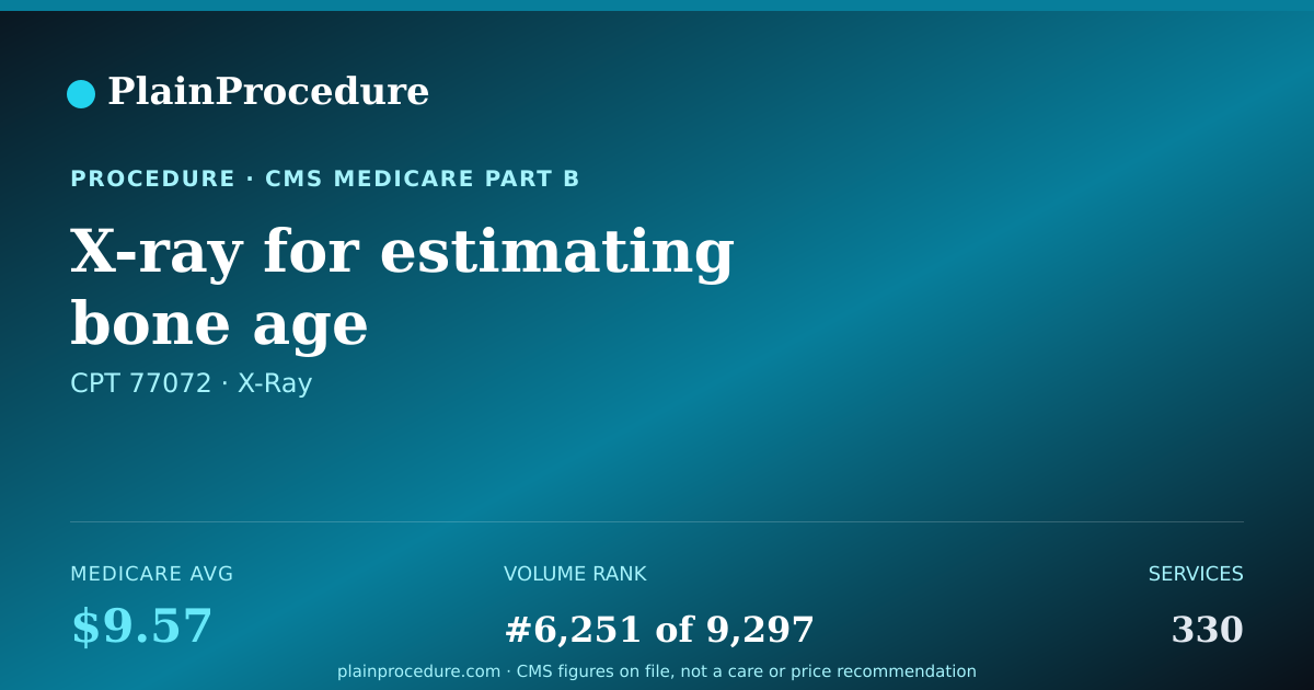 Shareable card for X-Ray For Estimating Bone Age