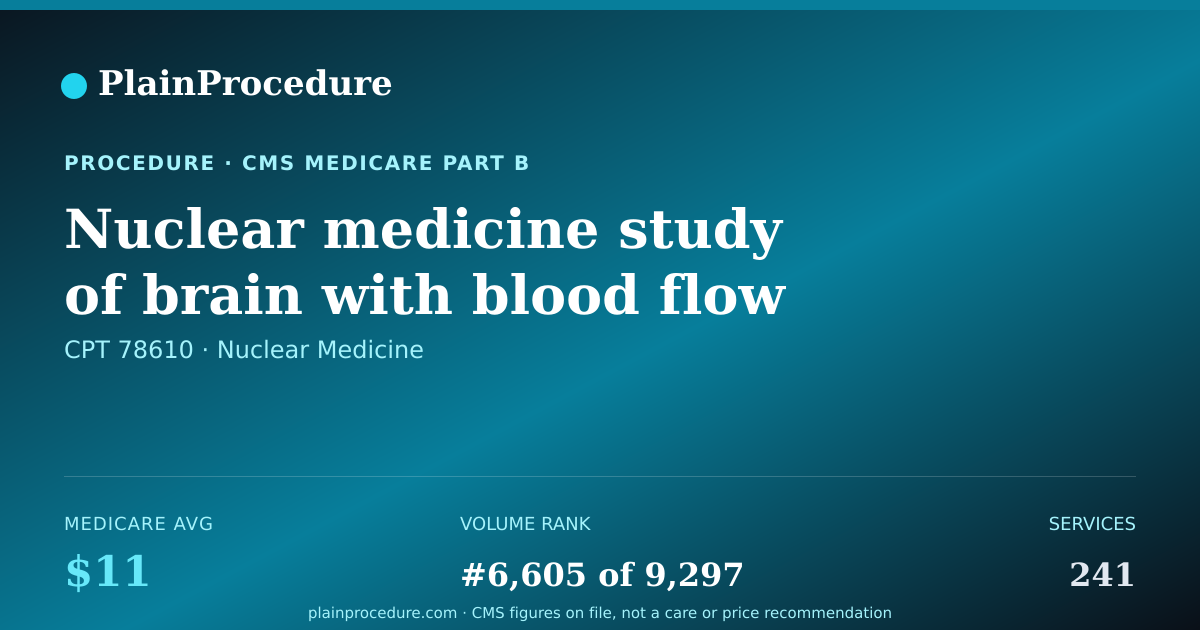 Shareable card for Nuclear Medicine Study Of Brain With Blood Flow