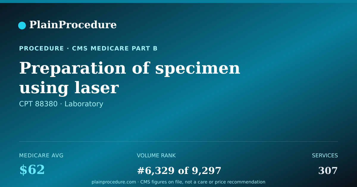 Shareable card for Preparation Of Specimen Using Laser