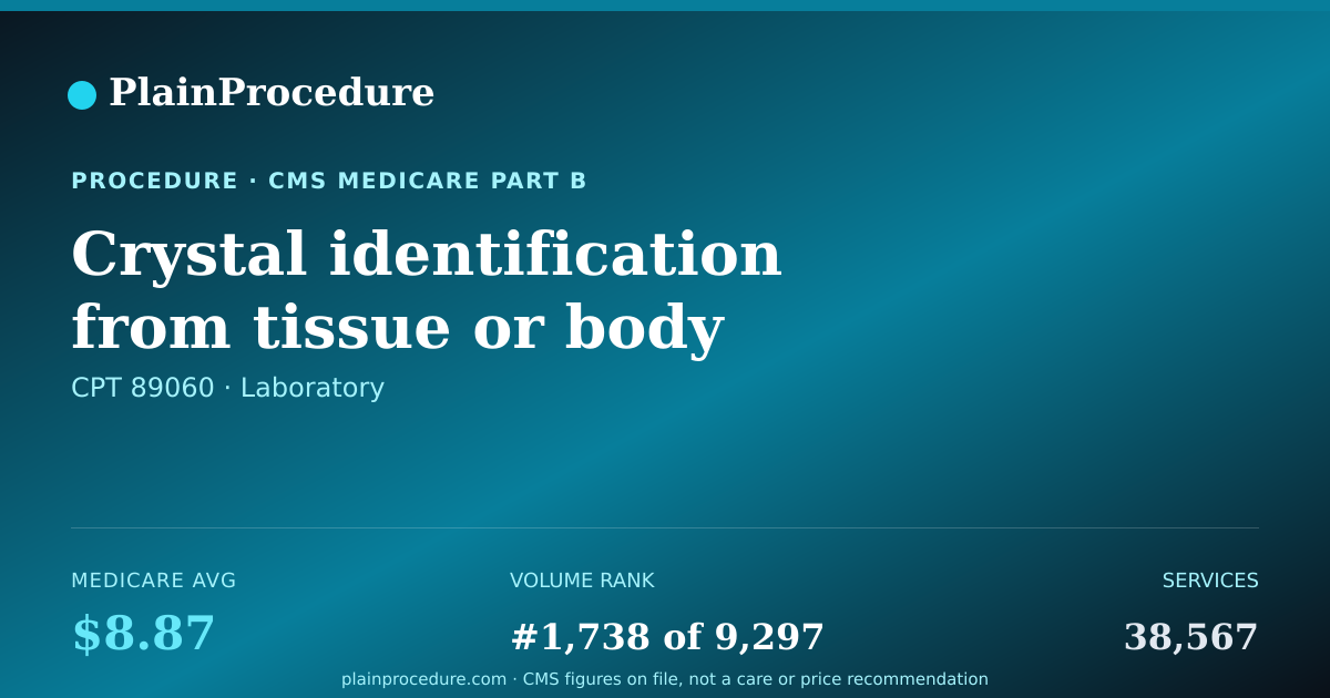 Shareable card for Crystal Identification From Tissue Or Body Fluid