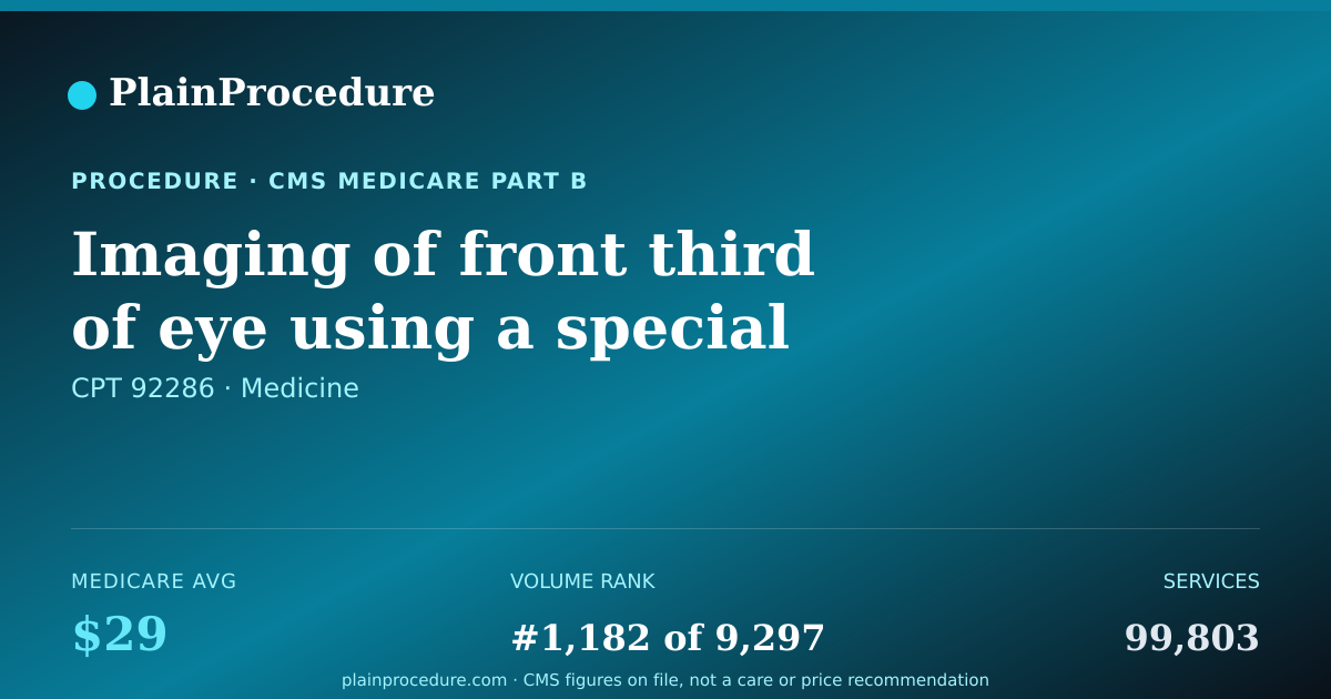 Shareable card for Imaging Of Front Third Of Eye Using A Special Microscope