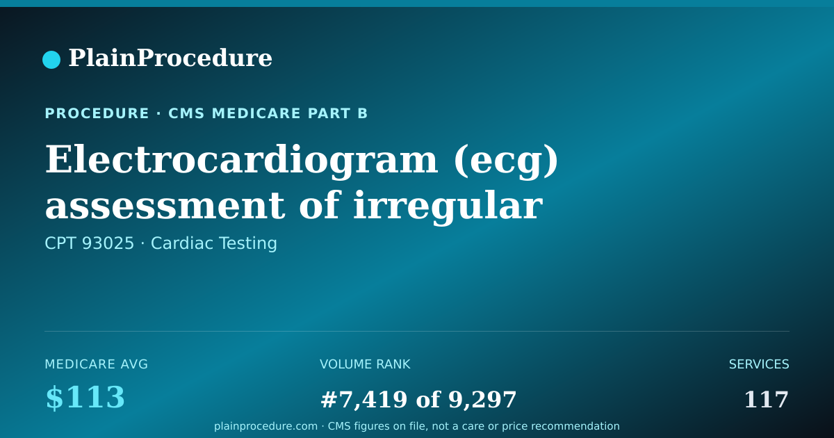 Shareable card for Electrocardiogram (ecg) Assessment Of Irregular Heart Beats