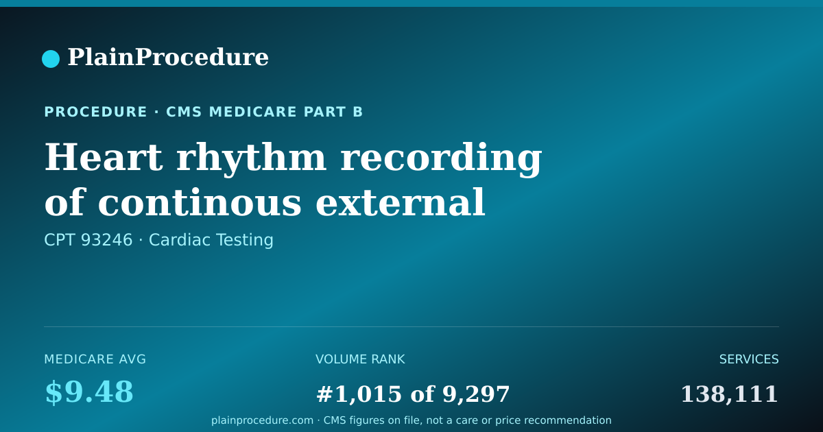 Shareable card for Heart Rhythm Recording Of Continous External Ekg Over 8-15 Days