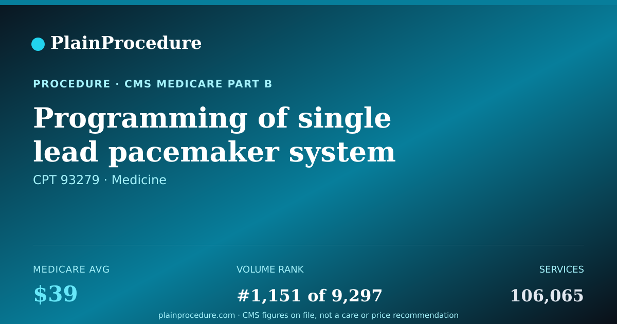 Shareable card for Programming Of Single Lead Pacemaker System
