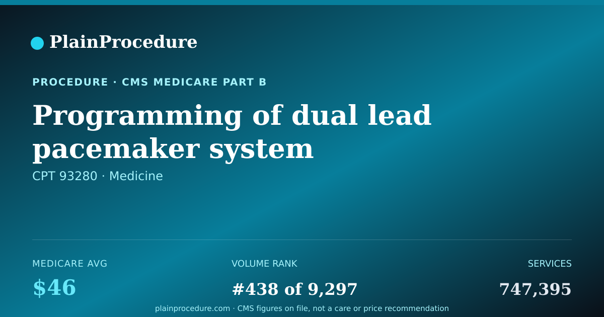 Shareable card for Programming Of Dual Lead Pacemaker System