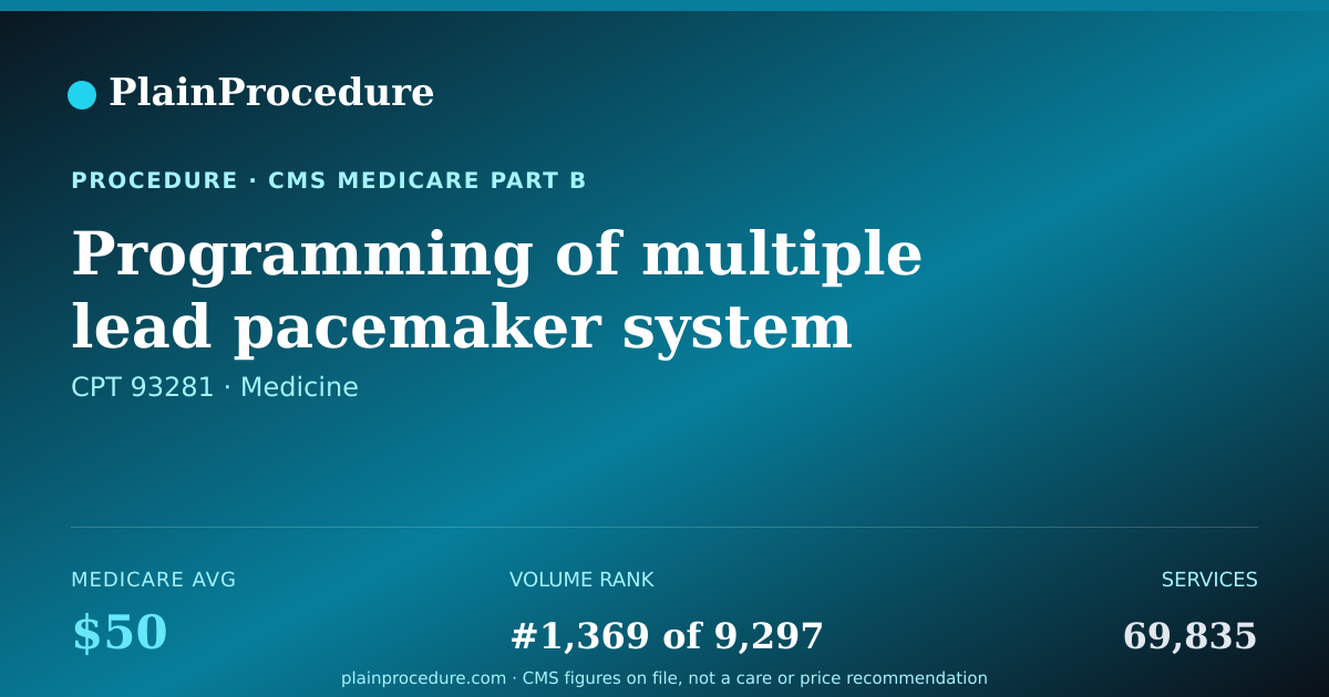 Shareable card for Programming Of Multiple Lead Pacemaker System