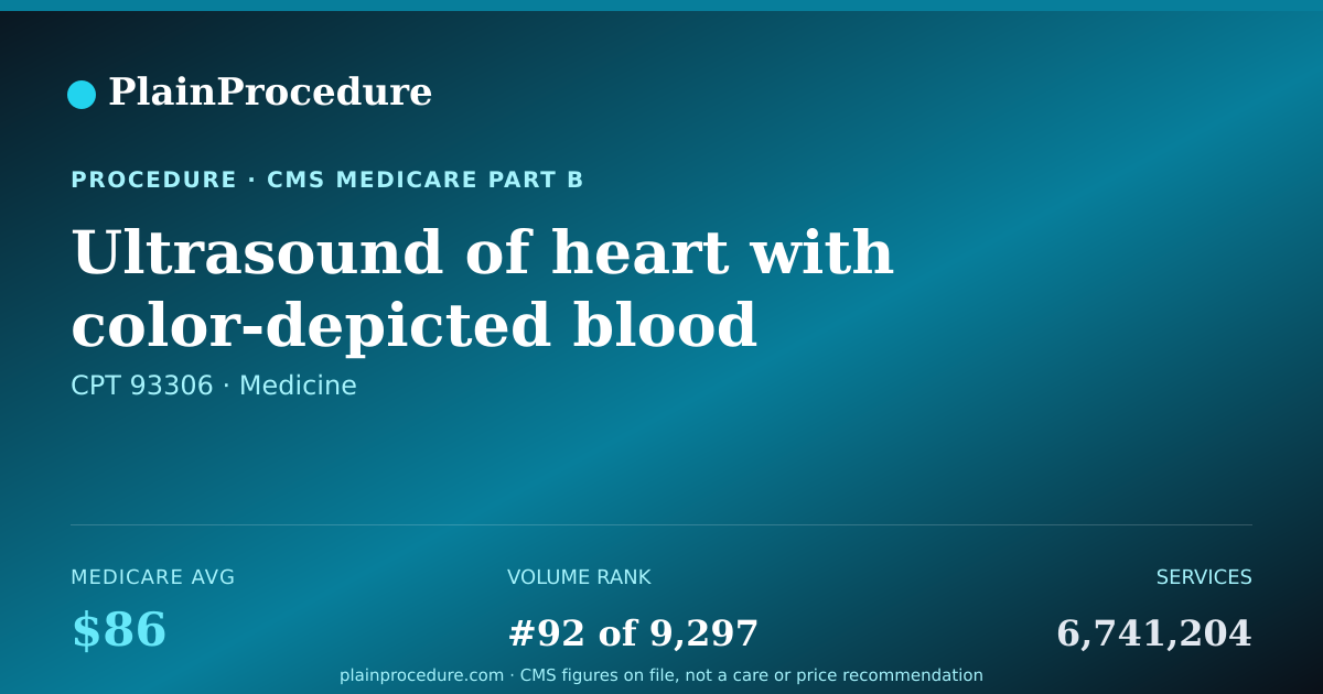 Shareable card for Ultrasound Of Heart With Color-Depicted Blood Flow, Rate, Direction And Valve Function