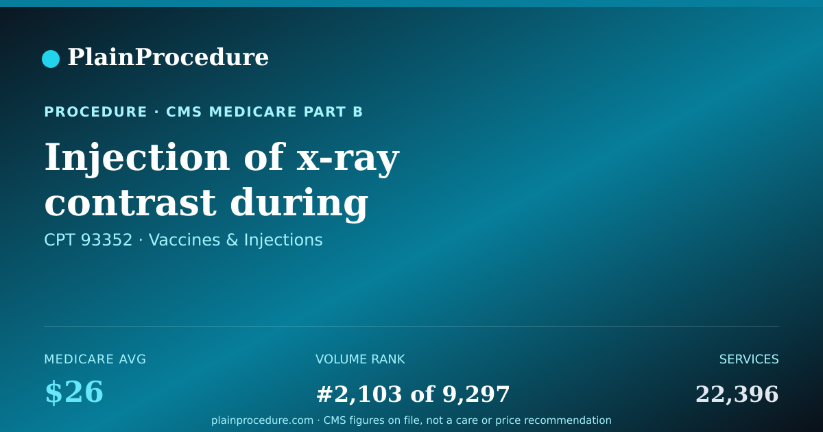 Shareable card for Injection Of X-Ray Contrast During Ultrasound Of Heart
