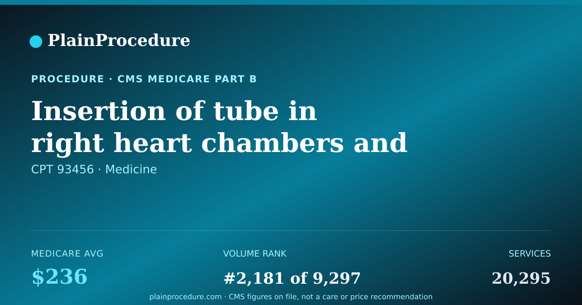 Shareable card for Insertion Of Tube In Right Heart Chambers And Coronary Artery For Diagnosis With Review By Radiologist