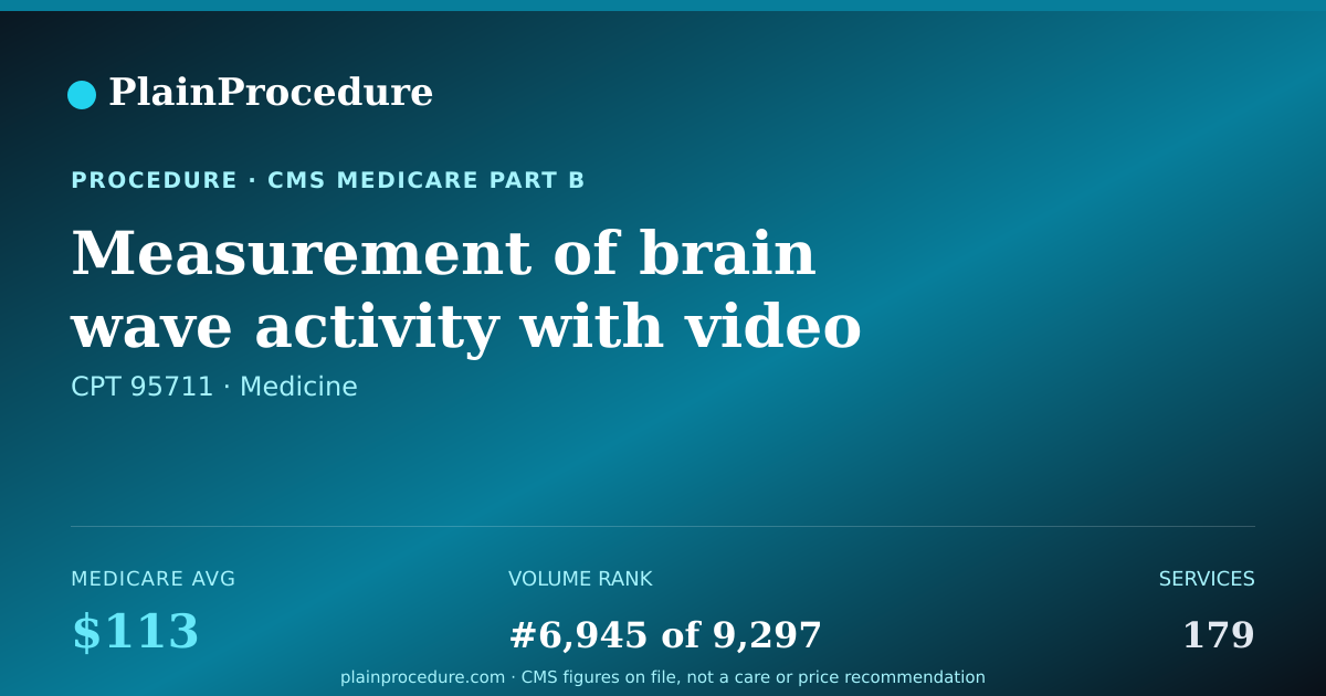 Shareable card for Measurement Of Brain Wave Activity With Video (veeg), 2-12 Hours