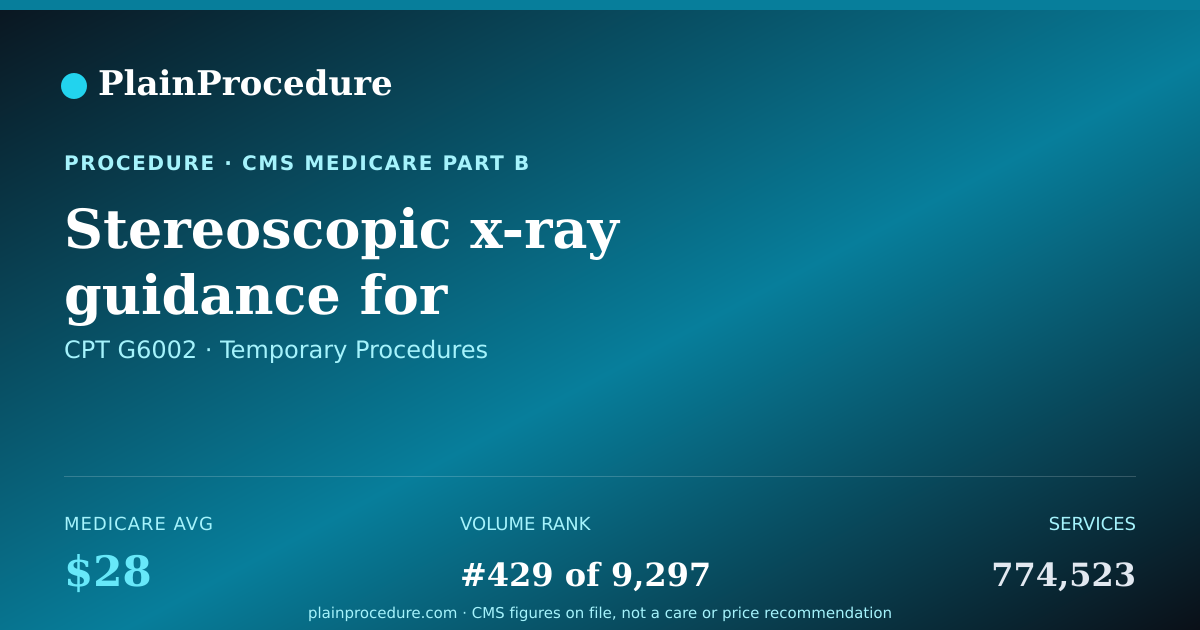 Shareable card for Stereoscopic X-Ray Guidance For Localization Of Target Volume For The Delivery Of Radiation Therapy